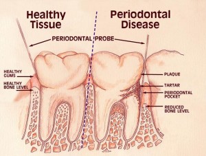 Nha-Khoa-Thien-Bao-Dental-Clinic-Periodontics-04